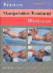 Fracture Manipulation Treatment Illustrated