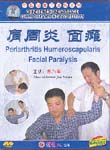 Periarthritis Humeroscapularis / Facial Paralysis