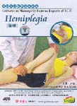 Lectures on Massage by Famous Experts of TCM: Hemiplegia