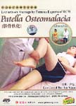 Lectures on Massage by Famous Experts: Patella Osteomalacia