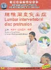 Lumbar Intervertebral Disc Protrusion